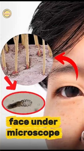 face under microscope 🔬🦠| Dorytalk