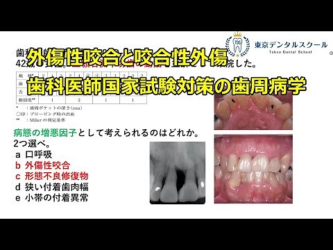 外傷性咬合と咬合性外傷 歯科医師国家試験対策の歯周病学