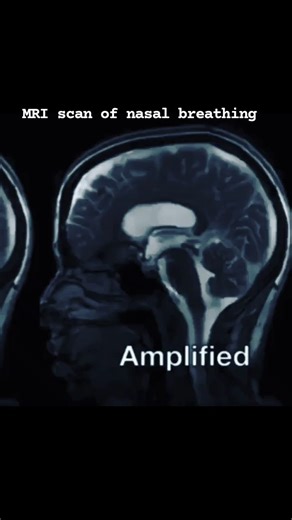 This MRI scan by scientists @stanford.med and Stevens Laboratory shows brain movements during nasal breathing. This particular study showed some exciting things: 🌬️ Inhales increase heart rate 🌬️ Exhales slow heart rate 🌬️ A 10 min breathing session can rewire vagal tone ! 🌬️ It's best to breath through the nose MOST of the time for improved health, performance and aesthetics of the face. For the novice, what this aptly demonstrates is the importance of breath and breathing technique. I do a