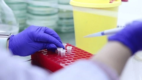 clip-4038530083-scientist-conducts-experiment-samples-test-tube-uses
