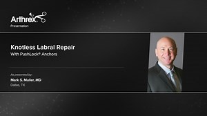 Knotless Labral Repair With PushLock® Anchors