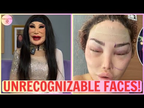 15 Plastic Surgeries That Went Horribly Wrong! | Then and Now 2025