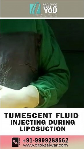 How is Tumescent Fluid Injected During Liposuction? Excess Body Fat Removal Process | Dr. PK Talwar