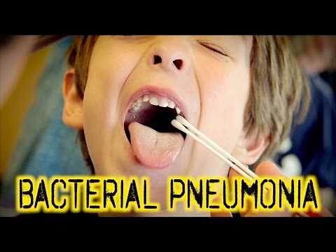 BACTERIAL PNEUMONIA: Diagnosis & Treatment | Dr. Paul