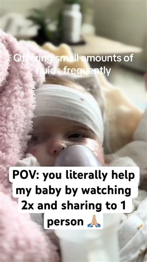 Join Elliana in fighting Junctional Epidermolysis Bullosa❤️#family #hope #donate #usa #cancer #uk