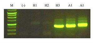 Designing PCR Primers to Amplify Target Genes