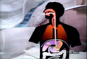 Endoscopy utilizing fibre optic imaging | Britannica