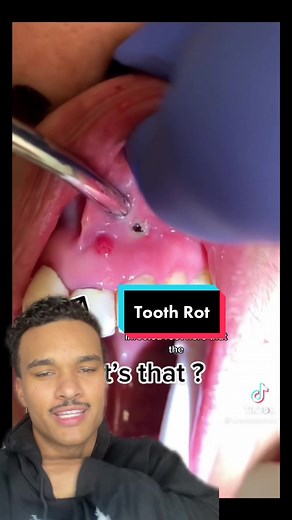 Mr.PopAlot on TikTok