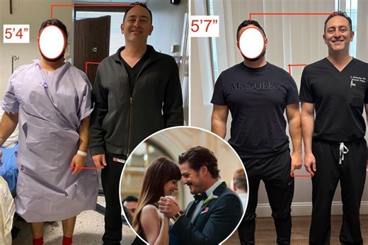 Leg-lengthening surgery from ‘Materialists’ is real — here’s why patients drop thousands on the ‘Frankenstein’ procedure