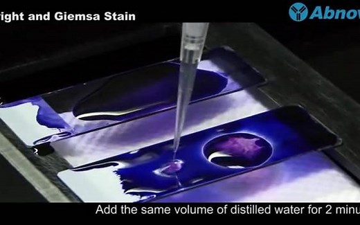 瑞氏姬姆萨复合染液/瑞氏吉姆萨复合染液Wright and Giemsa Stain