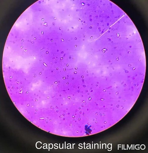Bacillus capsular and spore staining