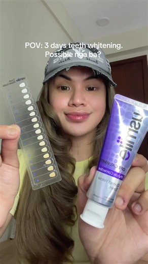 Effective Teeth Whitening Techniques for a Brighter Smile