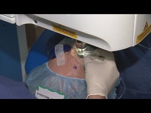 From cloudy to clear - New eye surgery fixes cataracts