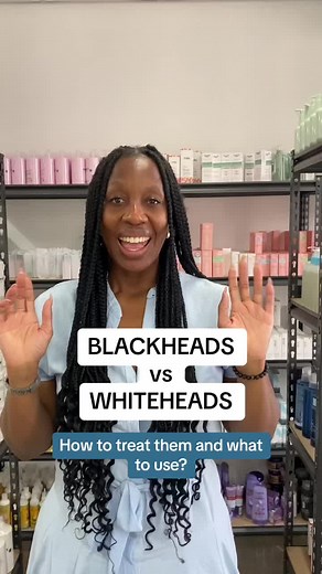Blackheads vs Whiteheads: How to Treat Them and Products to Use
