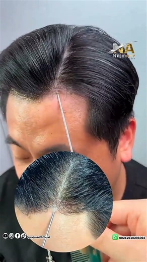 وداعًا للفراغات مع Hair System غير حياتك بالكامل 💎