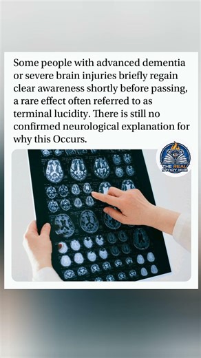 Terminal lucidity: A brief, clear return of awareness before death. #Dementia #TerminalLucidity