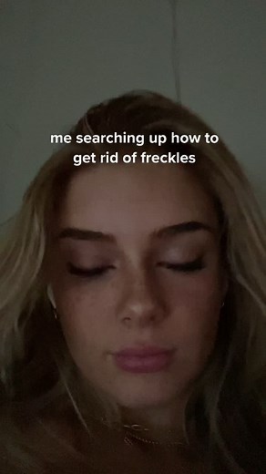 i love them now so it’s ok | Freckles