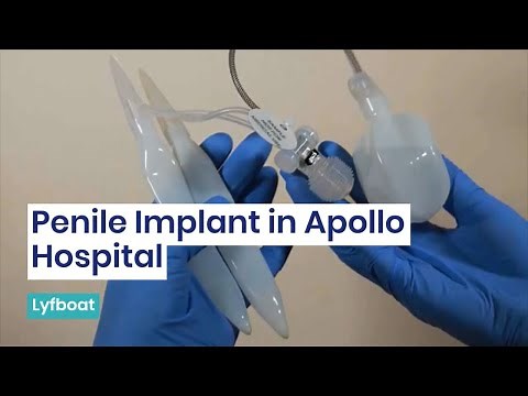 Penile Implant Surgery in Apollo Hospital | Penile Implant Cost in Indraprastha Apollo Hospital