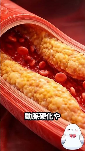 【医師解説】虚血性腸炎とは？血便・腹痛の原因と放置の危険性を徹底解説！