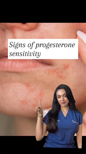 Mehraveh Sayyah on Instagram: "Progesterone sensitivity causes/worsens perioral dermatitis, acne, eczema, hives, or atopic dermatitis during the luteal phase. It affects skin barrier, oil glands, and immunity, often worsening before periods and mimicking other conditions. Track cycles, use anti-inflammatory skincare, consult a dermatologist, consider hormonal regulation (e.g. spironolactone or IUD), and avoid trigger products during the luteal phase. #progesterone #hormonalimbalance #hormones #d