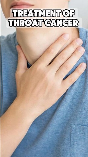 How To Treat Throat Cancer (Treatment Options)