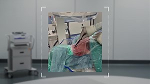 SpeedPearl: Cervical Central Decompression - Needle Placement Under Fluoroscopy