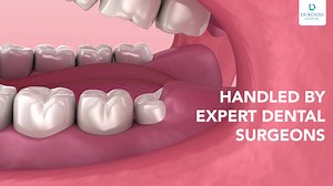 291 reactions · 21 shares | Experience painless precision in wisdom tooth removal handled by expert dental surgeons at Durdans Dental Clinic using advanced techniques for your comfort and safety. For more information 077 689 3102 | Durdans Hospital | Facebook