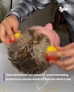 173K views · 271 reactions | This guy uses all kinds of unique products to get rid of dandruff...  | STUDENTbible | Facebook