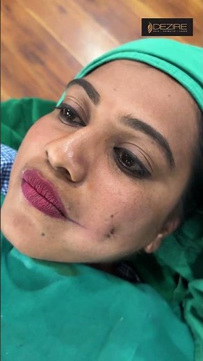 Dimple Creation | Dimple Result