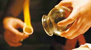 What Is Chinese Cupping Used For? (Ba Guan)