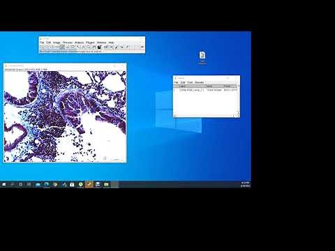 Collagen Determination in Histological Slide by ImageJ software.
