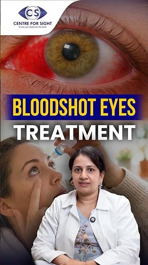 Red Eye or Blood Spot? When Should You Worry? | Dr. RVS Kalyani