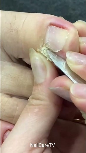 Cute Nail Satisfying Pedicure #SatisfyingPedicure #CuteNail #satisfying #trendingshorts