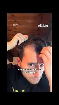 L'agence du médicament met en garde sur les traitements contre la calvitie