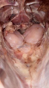 587K views · 611 reactions | Yall  im on turkey duty this year and im bout to pass out!!! I took the neck and the sealed bag of giblets out ... WHAT ARE THESE ??? Theyre attached to the turkey not loose to where i can just pull them out , googles not helping 勞勞‍‍‍‍ | Ashley Carlson | Facebook