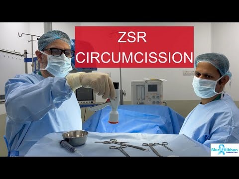 Circumcision Operation in Delhi India | ZSR for Phimosis or tight foreskin