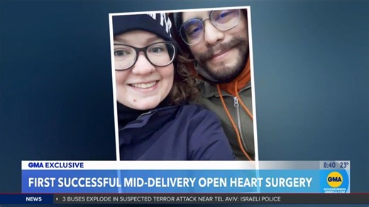 1st successful open heart surgery performed during birth - amazing story of an exit procedure where a baby is partially delivered but still attached to mother - during partial delivery the baby undergoes open heart surgery and after is fully delivered. https://abcnews.go.com/GMA/Wellness/video/1st-successful-open-heart-surgery-performed-birth-119035250 | Dr. Tara Narula