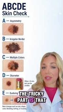 A normal mole and melanoma can look almost the same until you look closer. 🔬