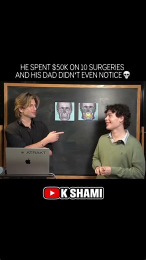 He Spent $50K on 10 Surgeries… His Dad Didn’t Notice 😳