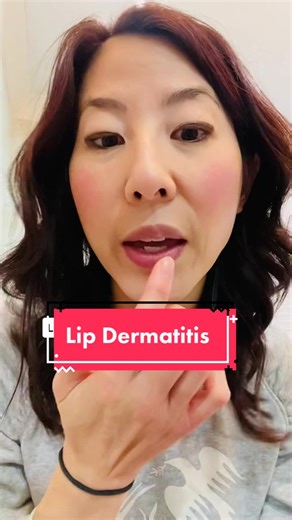 Effective Lip Dermatitis Treatments for Chapped Lips
