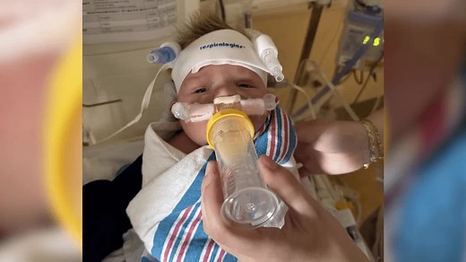 Baby allegedly almost bled to death in NICU after circumcision