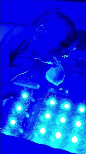 New Born Baby Jaundice Treatment Under Phototherapy 💡👶 | Cute Baby Moments in NICU ❤️ | #Shorts