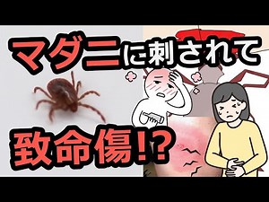 マダニに刺されて感染る感染症は？刺された時の対処法は？
