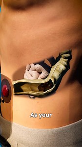 How A Colostomy Bag Works 🤔 | Zack D. Films