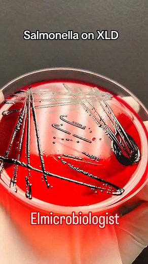 Xylose Lysine Deoxycholate (XLD) Agar is a selective and differential medium used to isolate enteric pathogens — especially Salmonella and Shigella — from stool cultures. Let’s decode what you see on the plate 👇 #Salmonella Ferments xylose → turns yellow at first Then decarboxylates lysine → reverts to red Produces H₂S → black centers 👉 Result: Red colonies with black centers #Shigella Doesn’t ferment xylose No H₂S production 👉 Result: Red colonies without black centers #Ecoli (or other colif