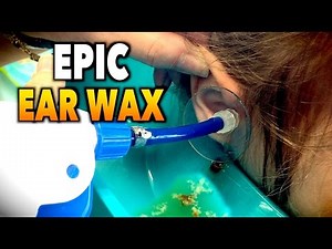 EPIC EARWAX REMOVAL! | Dr. Paul