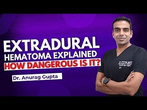 Extradural Hematoma Explained | How Dangerous Is It?