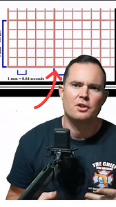 30K views · 396 reactions | Calculating rate can be challenging for those who don't know the sequence method. Counting a 6 second strip is the easiest way but sometimes you don't have a 6 second strip. #Paramedic #Nurse #EMS #EMT | Rescue Academy | Facebook