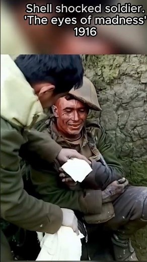 Colorized Footage: Shell shocked soldier, 1916 #ww1 #ai