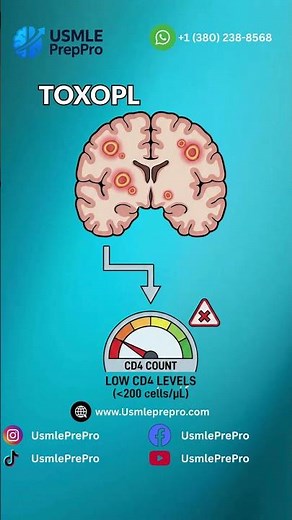 HIV CD4 Counts & Prophylaxis: Essential USMLE Prep